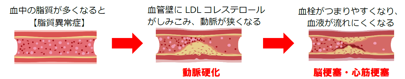 血管のイラスト